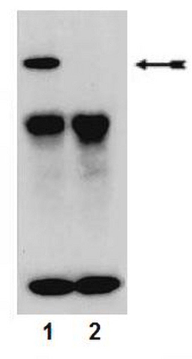 Anti-phospho-PKC (Ser657/Tyr658) Antibody