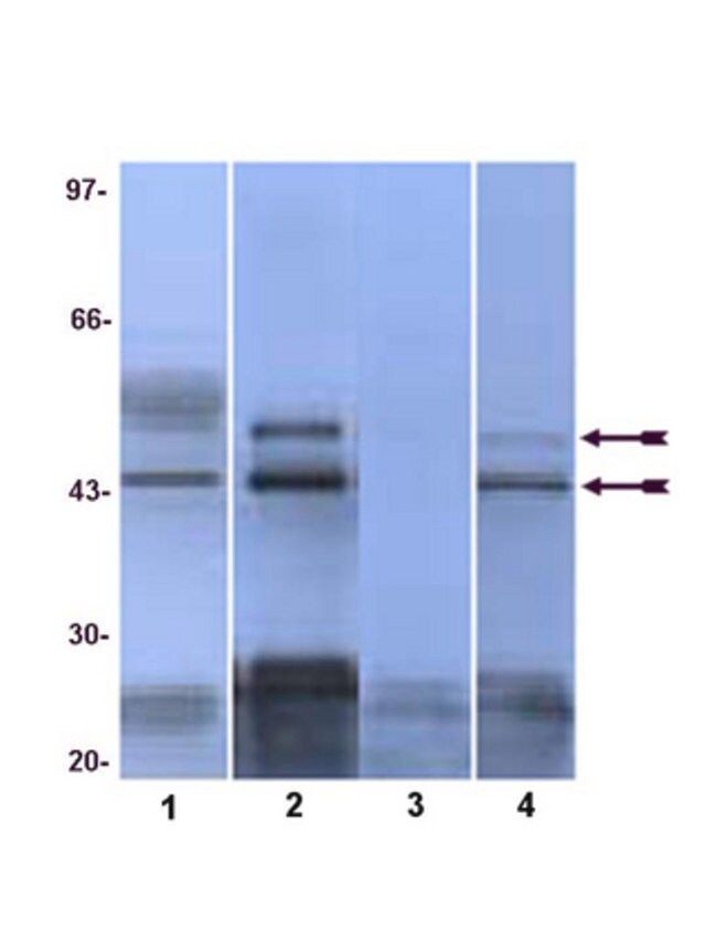 Anti-phospho-JNK (Thr183/Tyr185, Thr221/Tyr223) Antibody