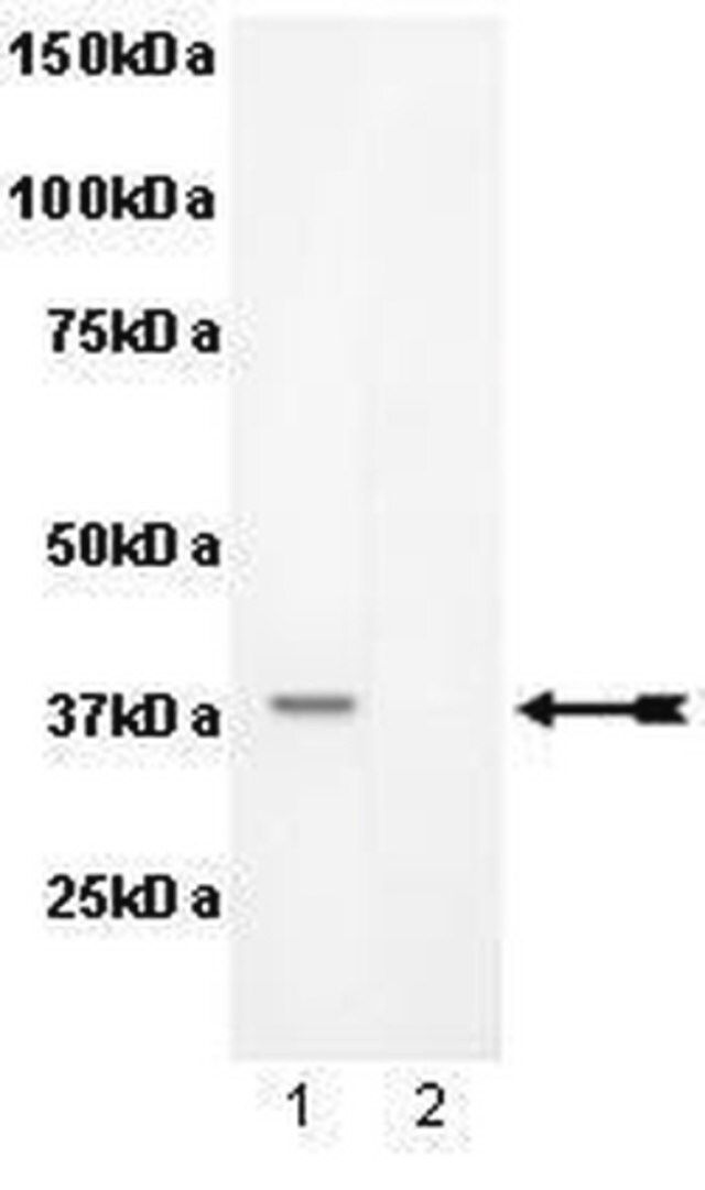 Anti-phospho-PKA Catalytic  subunit (Ser338) Antibody