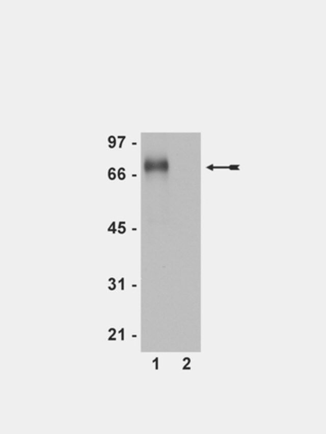 Anti-phospho-Flt-1 (Tyr1213) Antibody