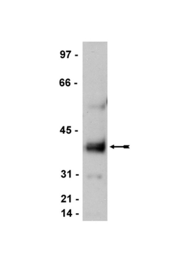 Anti-Stargazin/Cacng2 Antibody, CT