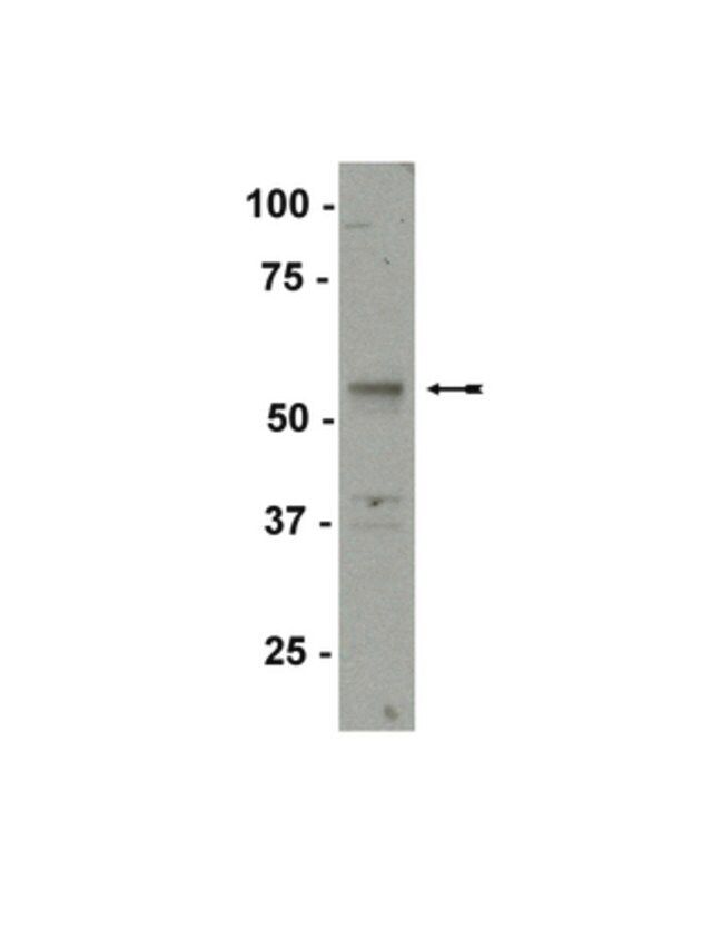 Anti-SF-1 Antibody