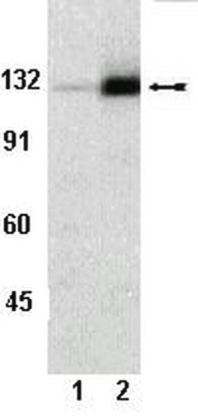 Anti-phospho-FAK (Tyr861) Antibody