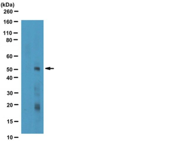 Anti-phospho-Smad3 (Ser423/425) Antibody