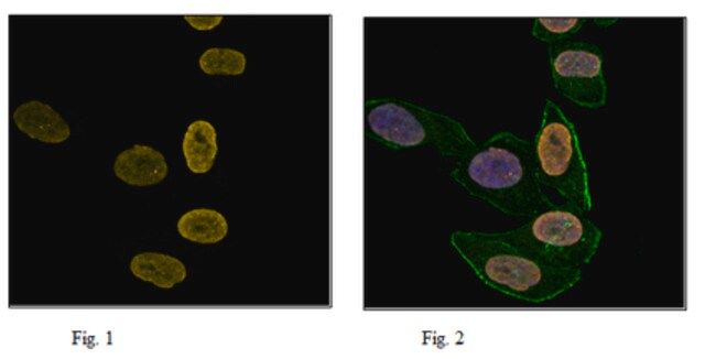 Anti-trimethyl Histone H3 (Lys27), Alexa Fluor<sup>®</sup> 647 Conjugate Antibody