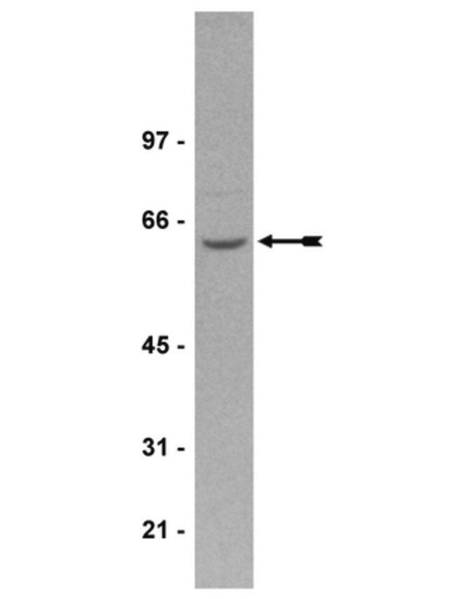 Anti-PP2A Antibody, A subunit