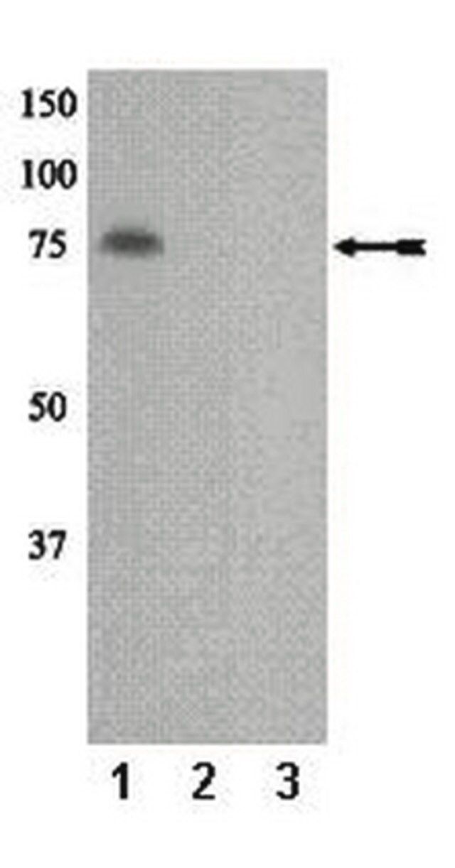 Anti-phospho-PKC (Thr655) Antibody