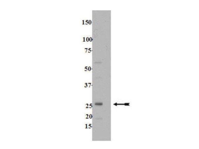 Anti-Rab13 Antibody