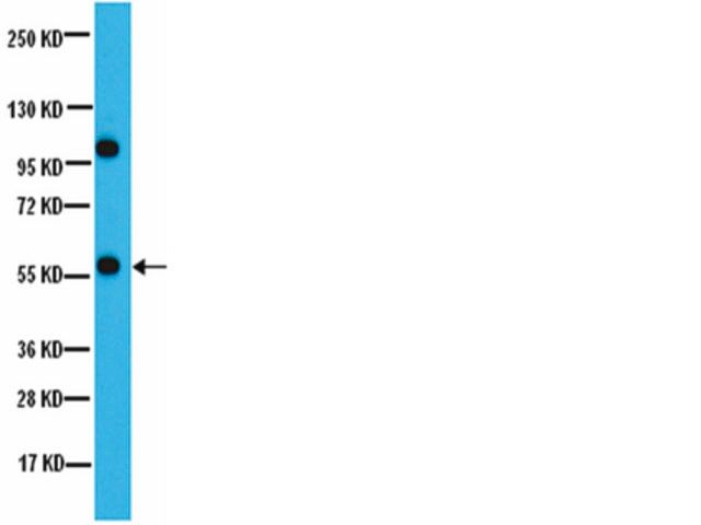 Anti-PP2A-B (B56) Antibody