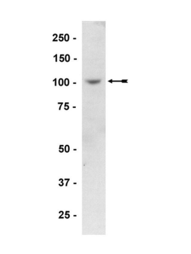 Anti-PKD2 Antibody