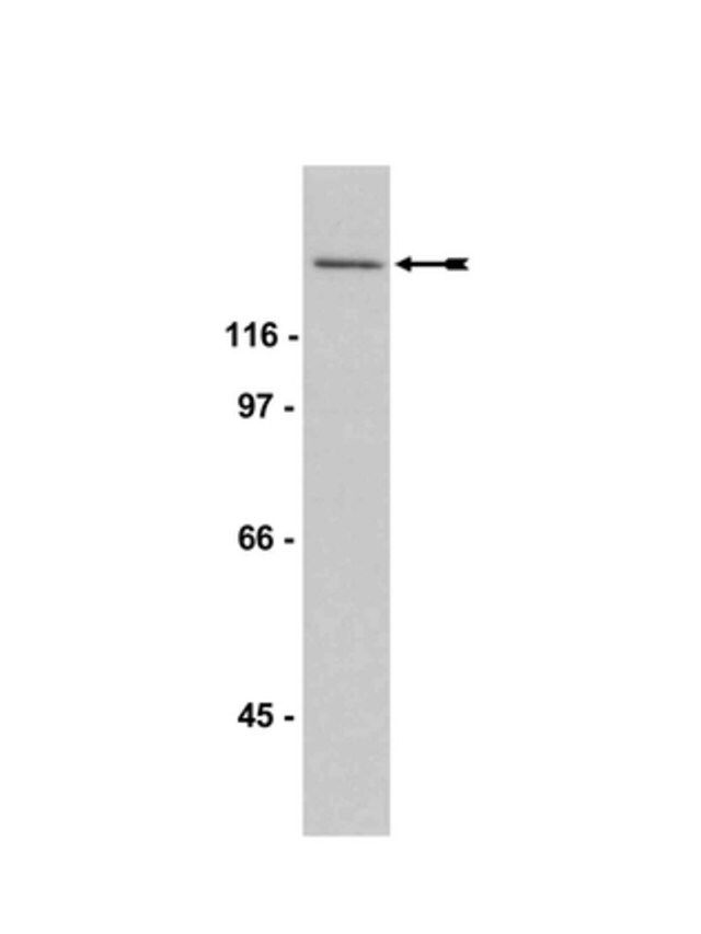 Anti-SOS1 Antibody, CT