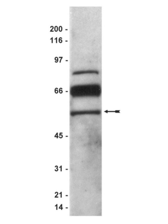 Anti-PEDF Antibody