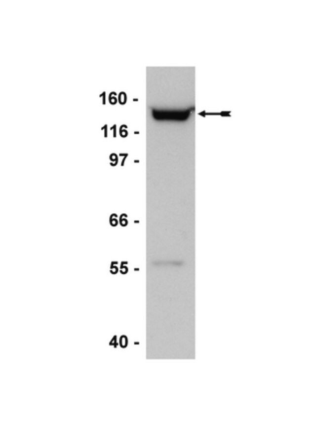 Anti-SMC2/hCAP-E Antibody