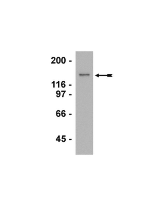 Anti-G9a Antibody