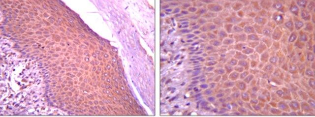 Anti-SOX1 Antibody