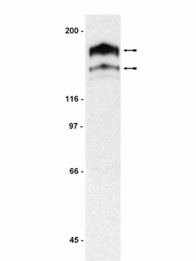 Anti-PDGFR Antibody