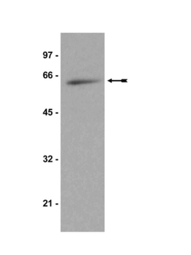 Anti-p70 S6 Kinase Antibody