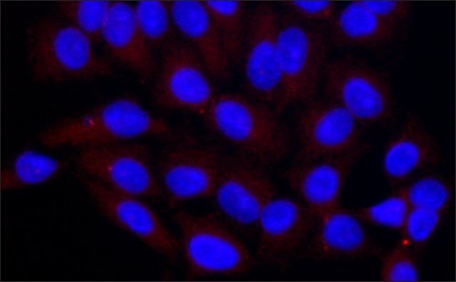 Anti-ALIX (C-terminal) antibody produced in rabbit