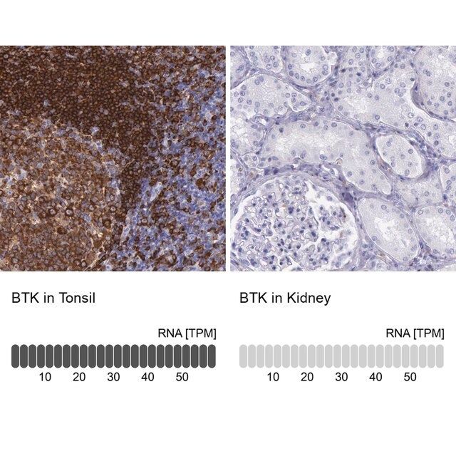 Anti-BTK antibody produced in rabbit