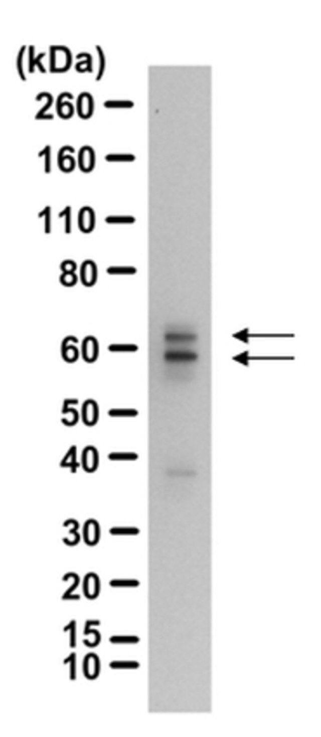 Anti-GAD65 Antibody