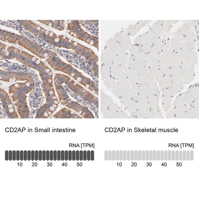 Anti-CD2AP antibody produced in rabbit