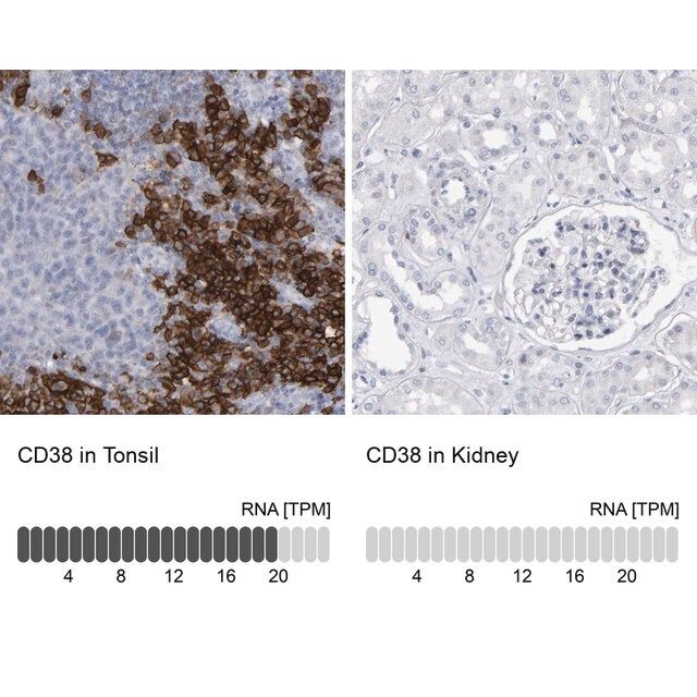 Anti-CD38 antibody produced in rabbit