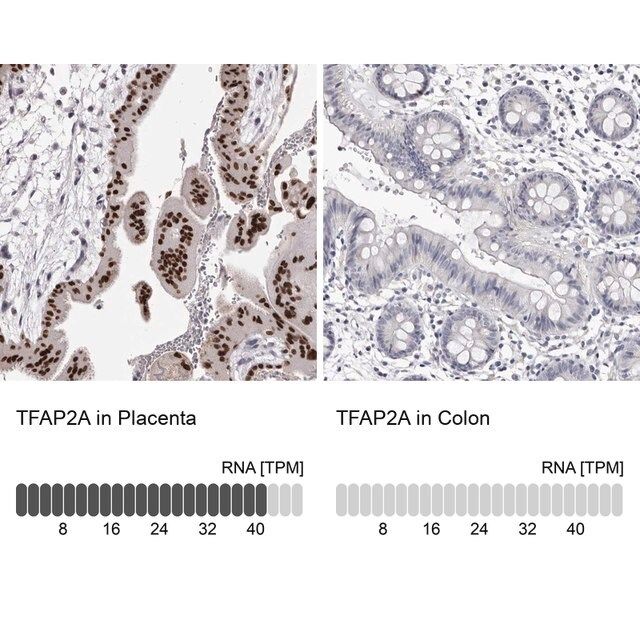 Anti-TFAP2A antibody produced in rabbit