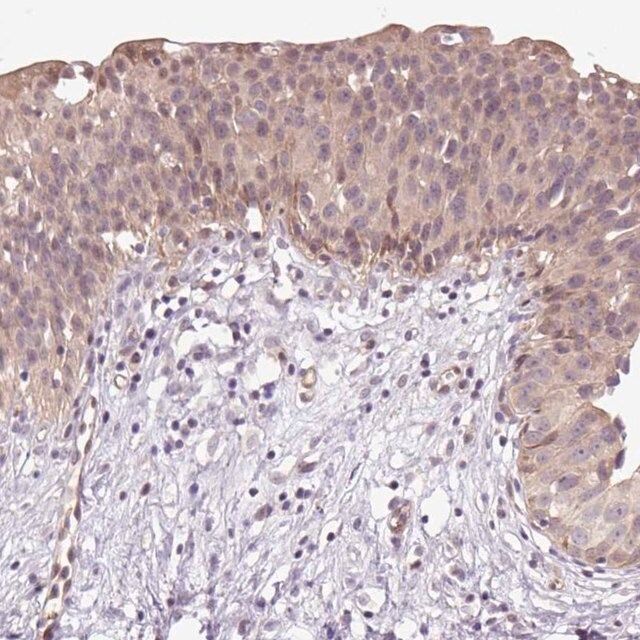 Anti-TPT1 antibody produced in rabbit