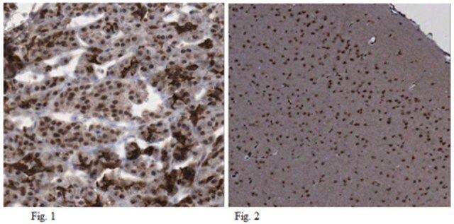 Anti-MNX1 (HB9) Antibody