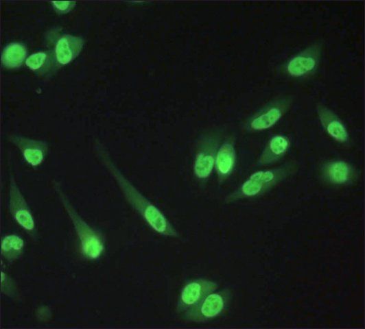 Anti-RbAp48/RbAp46 antibody produced in rabbit