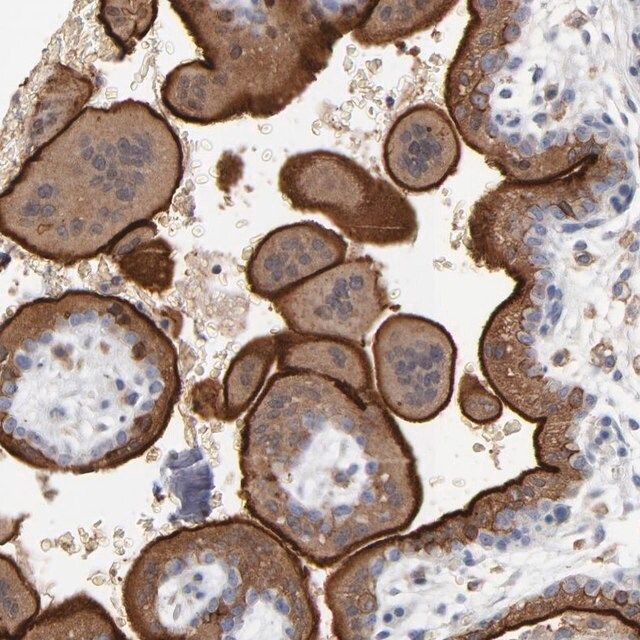 Anti-PDLIM2 antibody produced in rabbit