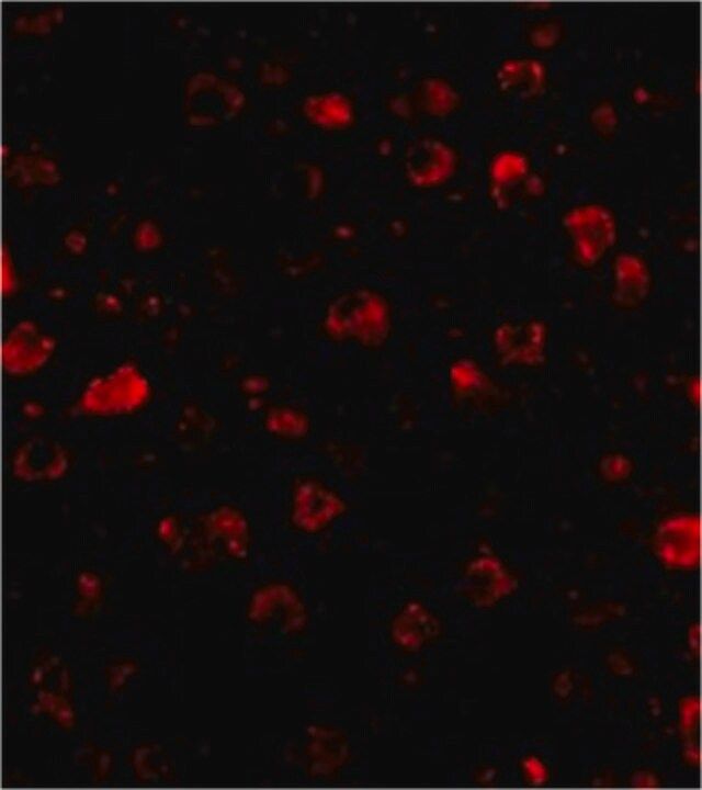 Anti-SATB1 Antibody