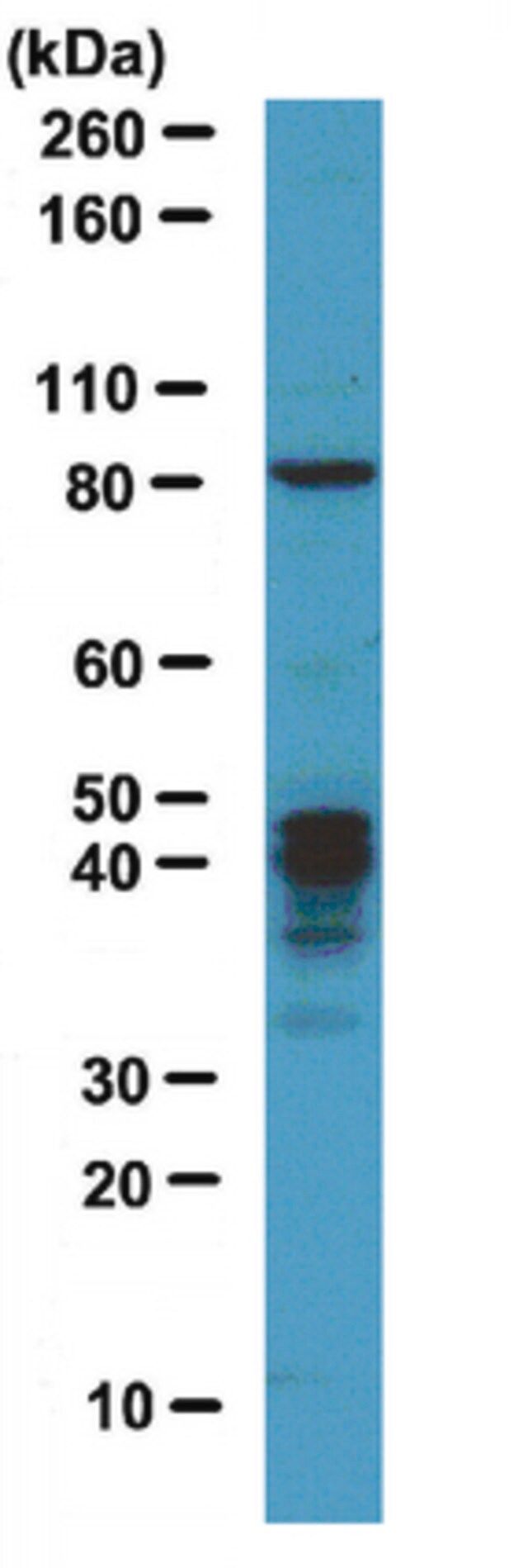 Anti-MBNL1 Antibody