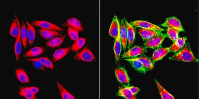 Anti-Vimentin Antibody, clone VIM 3B4