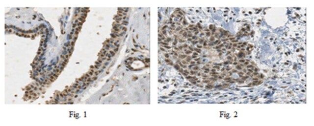 Anti-PALB2 Antibody