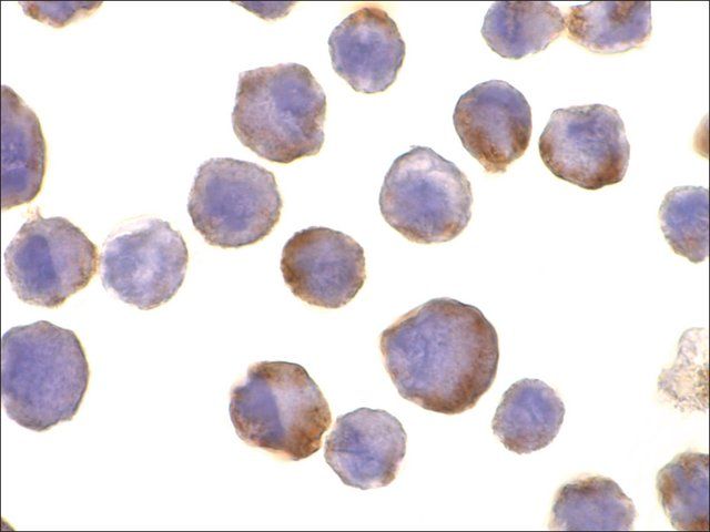 Anti-TACE antibody produced in rabbit