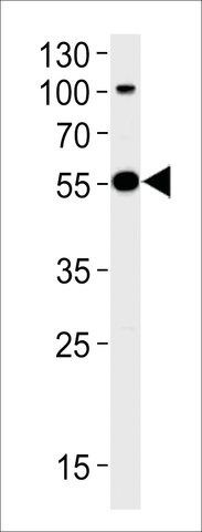 ANTI-PARKIN(N-TERMINAL) antibody produced in rabbit