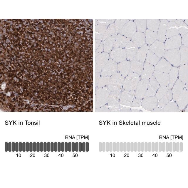 Anti-SYK antibody produced in rabbit