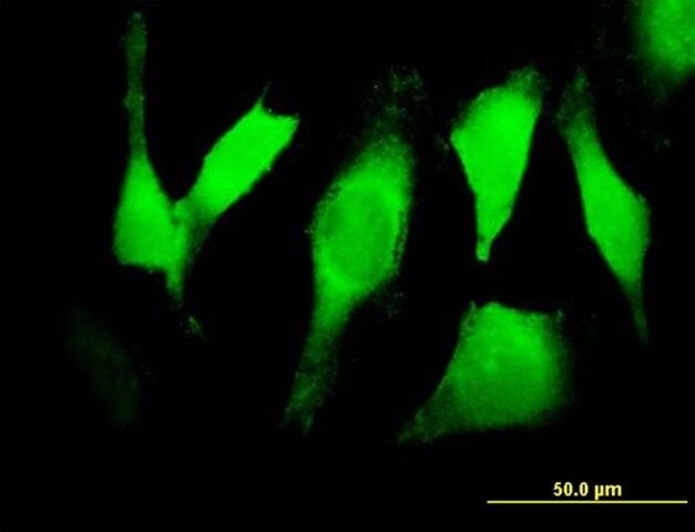 Anti-EGFR antibody produced in mouse