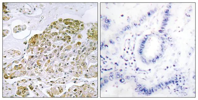 Anti-TFEB antibody produced in rabbit