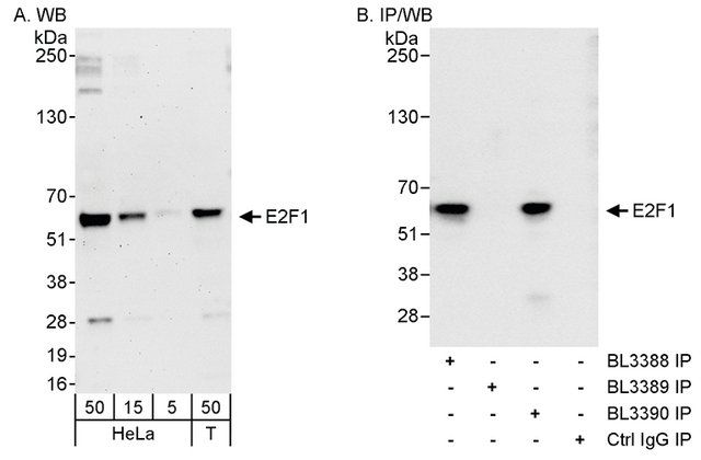 Rabbit anti-E2F1 Antibody, Affinity Purified