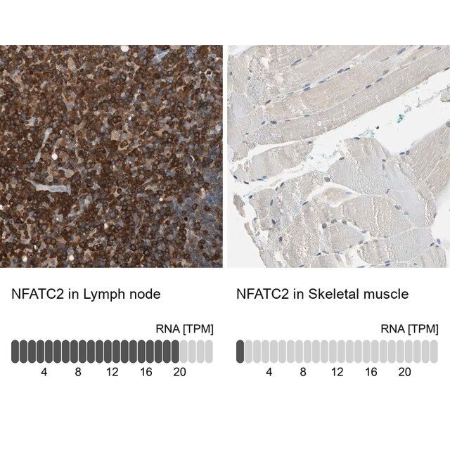 Anti-NFATC2 antibody produced in rabbit