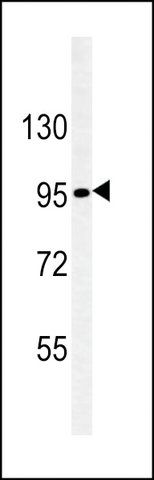 MONOCLONAL ANTI-NEPHRIN antibody produced in mouse