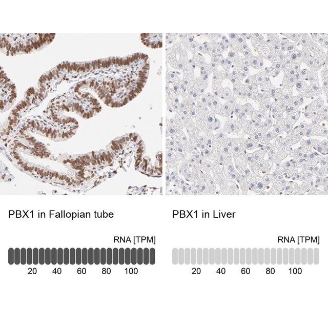 Anti-PBX1 antibody produced in rabbit