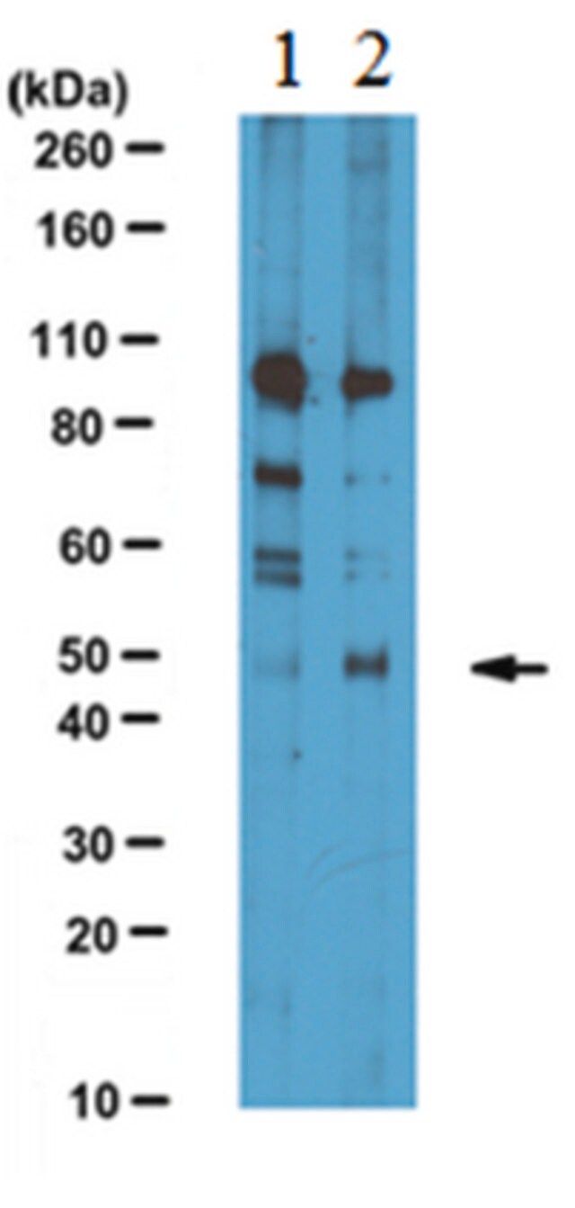 Anti-ATF4 Antibody