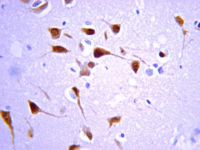 Anti-Choline Acetyltransferase (ChAT) Antibody