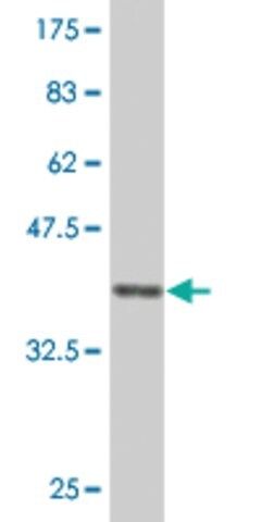 Monoclonal Anti-UNC13D antibody produced in mouse