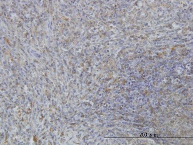 Monoclonal Anti-MARCKS antibody produced in mouse