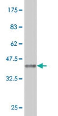 Monoclonal Anti-CA7 antibody produced in mouse