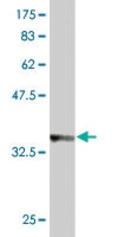 Monoclonal Anti-AP3B1 antibody produced in mouse